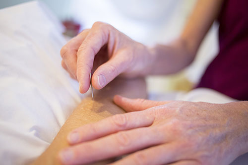 Advertise your Acupuncture services to local Calgary area patients.